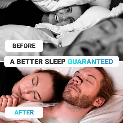 BreatheEase Kit: Sports Nasal Dilators for Snoring and Sleep Improvement